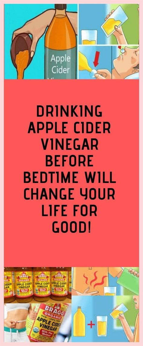 fat burning foods Apple Cider Vinegar Mother, Frankincense Oil Uses, Mushroom Benefits, Calendula Benefits, Walking Plan, Apple Cider Vinegar Drink, Vinegar And Honey, Organic Apple Cider, Organic Apple Cider Vinegar