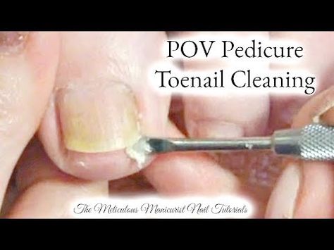 POV Salon Pedicure Tutorial Up Close Big Toenail Limpieza Real Time - YouTube Clean Toenails, Pedicure Tutorial, Toenail Health, Diy Pedicure, Acrylic Nails At Home, Ingrown Toenail, Cleaning Videos, Ingrown Nail, How To Cut Nails