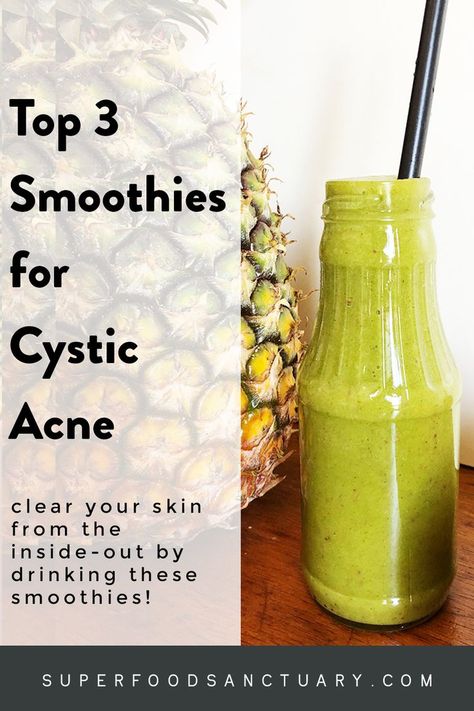 Having cystic acne is no joke. Like what’s with the painful huge under-the-skin bumps?! The best way to fight these freakazoids is from the inside-out. Try 3 green smoothies for cystic acne! Acne Free Diet, Under The Skin Acne, Acne Drink, Remedies For Back Acne, Back Acne Remedies, Acne Diet, Back Acne, Skin Drinks, Juice Cleanse Recipes