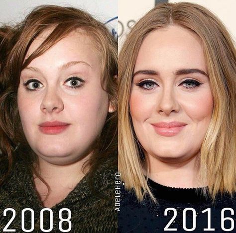 Adele: before and after Adele Before And After, Adele Before, Celebrities Before And After, Adele, Then And Now, Celebrities, Beauty