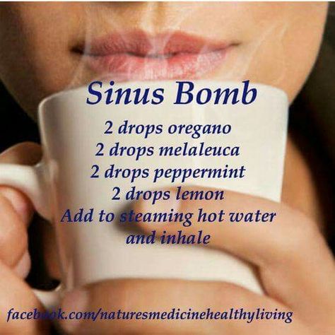 Sinus Remedies, Essential Oil Remedy, Oil Remedies, Diy Kosmetik, Essential Oils Health, Yl Essential Oils, Sinus Infection, Doterra Oils, Young Living Oils