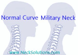 Military Neck - What Is It? Should It Be Corrected? & How To Fix It Cervical Spine Exercises, Strengthen Your Back, Posture Brace, Neck Traction, Neck Exercises, Elevate Your Life, Psoas Muscle, Spine Surgery, Cervical Spine