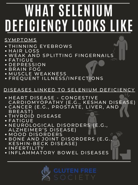 Does Gluten Cause Selenium Deficiency - Gluten-Free Society Selenium Deficiency Symptoms, Selenium Benefits, Selenium Deficiency, Thyroid Healing, Sick Remedies, Hashimotos Disease, Thyroid Health, Adrenal Fatigue, Health Guide