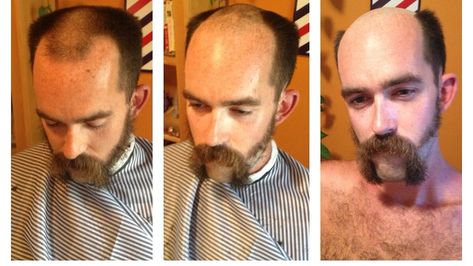 Male Pattern Baldness Hairstyles, Shaved Head With Beard, Bald Men With Beards, Bald Men Style, Bald Look, Male Pattern Baldness, Pattern Baldness, Fringe Fashion, Beefy Men