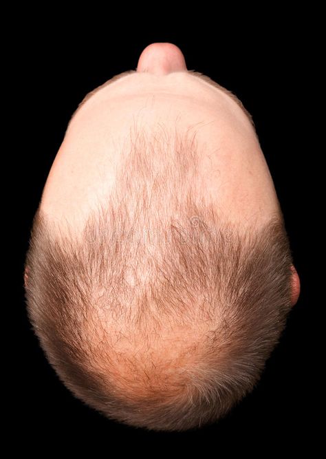 Bald head cut-out. A balding head viewed from above, isolated against a black ba , #Ad, #cut, #balding, #Bald, #head, #black #ad From Above Reference, Head From Above, Bald Head, Bald Heads, Hair Fibers, Stock Photography Free, Air Pump, Hairstyle Ideas, Keratin