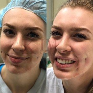 Dimple Surgery, Islamabad Pakistan, Beauty Queen, Cosmetic Surgery, Beauty Queens, Healthy Body, Surgery, The Beauty, Pakistan