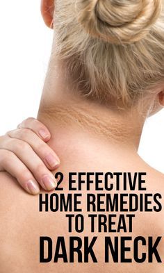 Many people experience dark neck that results from improper skin care or hyper pigmentation. Here are home remedies for dark neck you should try to abate the dark neck skin. Dark Neck, Hyper Pigmentation, Skin Care Routine For 20s, Skin Remedies, Skin Care Remedies, Sagging Skin, Skin Care Treatments, Skin Care Women, Simple Skincare