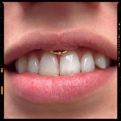 Smiley Piercing - Piercing Idea Cute Piercings Face, Cute Face Piercings, Smiley Piercing Jewelry, Smile Piercing, Piercing Face, Mouth Piercings, Jewel Tattoo, Smiley Piercing, Face Piercings