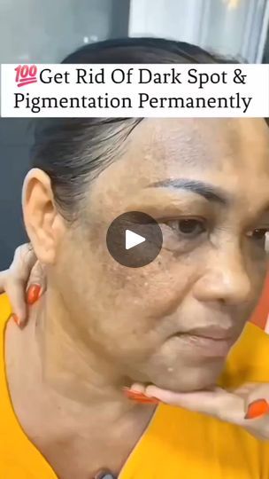 55K views · 330 reactions | Try This Effective Remedy to Reduce Pigmentation and Dark Spot. Get Spotless and Glowing Skin
#reel #darkspots #glowingskin #skinwhitening #WrinkleFreeSkin #hacks #skincare | Natural Beauty Remedy Body Care Tips, Pimple Free Skin, Health Care Tips, Top Anti Aging Products, Wrinkle Free Skin, Natural Beauty Remedies, Skincare Natural, Anti Aging Oils, Skin Lightening