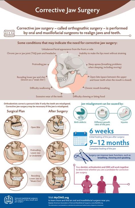 Corrective Jaw Surgery, Patient Care Coordinator, Orthognathic Surgery, Maxillofacial Surgery, Oral Maxillofacial, Wisdom Tooth, Jaw Surgery, Oral Surgeon, Dental School