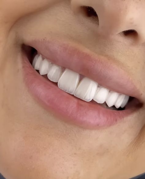 Perfect Natural Teeth, Straight Teeth Aesthetic, Bunny Teeth Aesthetic, Perfect Teeth Aesthetic, White Teeth Aesthetic, Perfect Teeth Smile, Perfect Smile Teeth, Smile Tips, Good Teeth