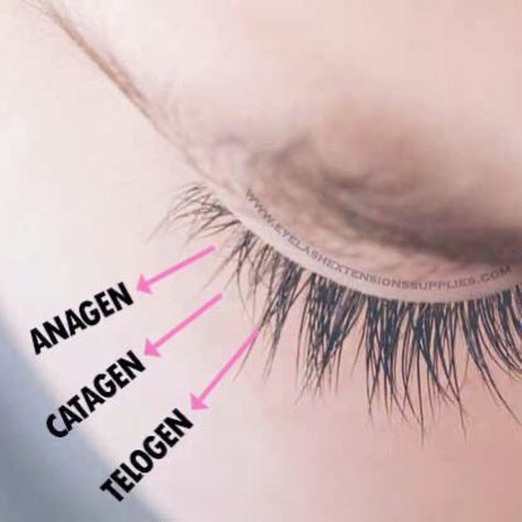 The lash line has about 90 to 150 lashes on it, which grow in three-phase growth cycle and eventually fall out.𝗧𝗵𝗲 𝗮𝗻𝗮𝗴𝗲𝗻 phase is also called the growth phase. This is the phase when lashes are actively growing, and it lasts between 30 and 45 days.𝗧𝗵𝗲 𝗰𝗮𝘁𝗮𝗴𝗲𝗻 phase is also known as the transition phase. During this phase, the lash stops growing and the hair follicle shrinks. This phase lasts between two and three weeks.𝗧𝗵𝗲 𝘁𝗲𝗹𝗼𝗴𝗲𝗻 phase is also referred to as the re Eyelash Growth Cycle, Lash Extensions Styles, Lash Growth, Eyelash Growth, Hair Follicle, Lash Extensions, Eyelash Extensions, Eyelashes, Lashes