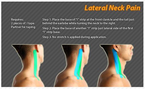 Cervical Instability, Sports Taping, K Tape, Kt Tape, Kinesio Taping, Conditioning Workouts, Kinesiology Taping, Massage Benefits, Neck And Back Pain