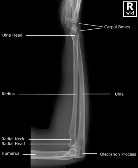 Anatomi Dan Fisiologi, Radiography Student, Radiology Schools, Medical Radiography, Radiologic Technology, Radiologic Technologist, Radiology Student, Radiology Technician, Radiology Imaging