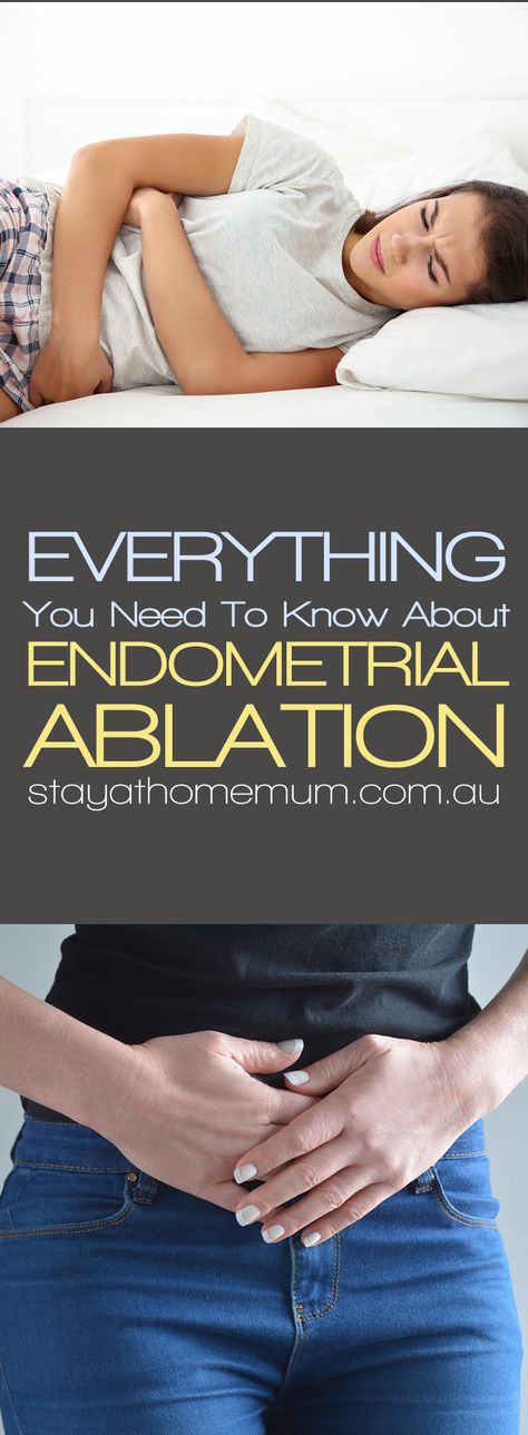 Ablation Surgery, Preparing For Surgery, Period Problems, Hormonal Birth Control, Stay At Home Mum, Clogged Arteries, Surgery Recovery, Period Pain, Menstrual Cramps