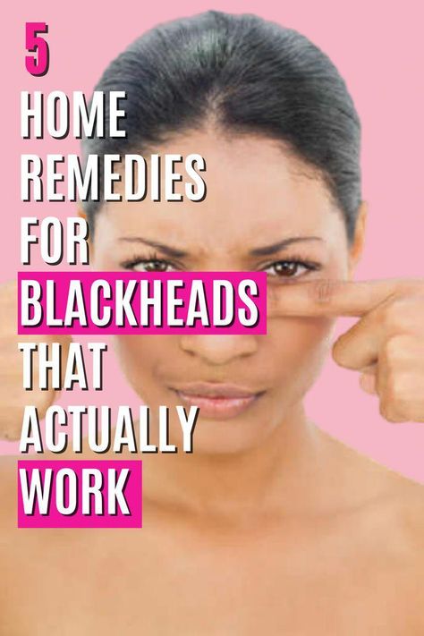 #LowCarbLowSugarDinnerRecipes Blackhead Remedies, Blackheads On Nose, Black Heads, Home Remedy For Cough, Skin Natural Remedies, Cold Sores Remedies, Types Of Acne, Natural Sleep Remedies, Natural Cold Remedies