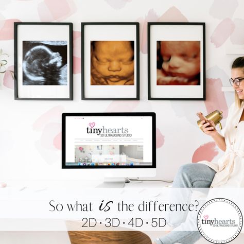 Ultrasound Studio, 3d Ultrasound, 4d Ultrasound, Hospital Interior, Baby Frame, Hospital Interior Design, Hospital Design, Tiny Heart, Test Tube