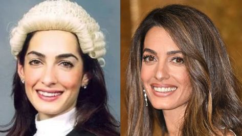 Many people believe Amal Clooney’s stunning face is the result of plastic surgery. She has reportedly received Botox injections, facelifts, eyelid surgery, fillers, and even rhinoplasty. However, the truth has yet to be revealed. Eyelid Filler, Rhinoplasty Surgery, Botox Injections, Amal Clooney, Many People, Plastic Surgery, The Truth, Surgery, Beauty