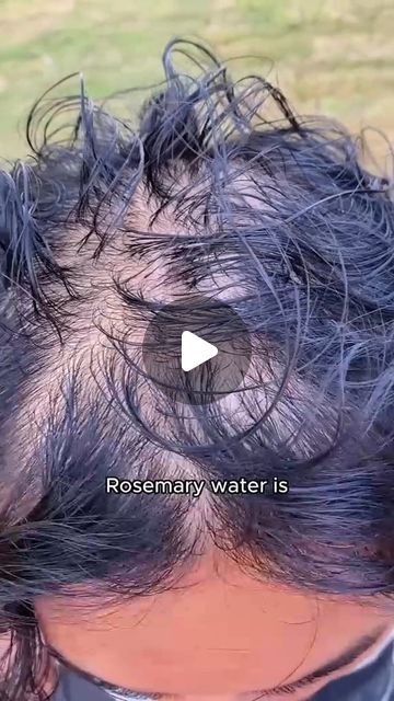 Rosemary Oil Recipe, Rosemary For Hair, Hair Growth Oil Recipe, Thining Hair, Rosemary Water, Hair Growth For Men, Rosemary Oil For Hair, How To Grow Your Hair Faster, Hair Growing Tips