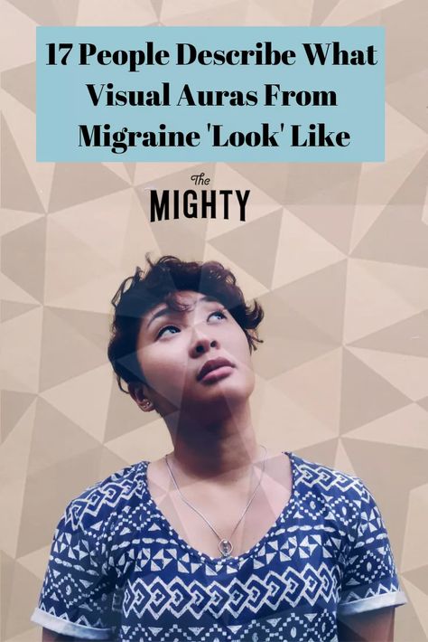 Migraine Aura Image, Visual Migraine, Aura Migraine, Silent Migraine, Visual Snow, Migraine Aura, Forward Head Posture Exercises, Migraine Triggers, Throbbing Headache