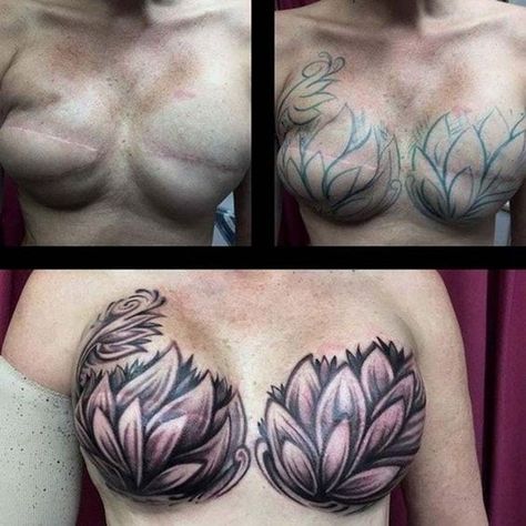 Mastectomy Scar Tattoo, Tatuaje Cover Up, Mastectomy Scars, Tattoo Over Scar, Mastectomy Tattoo, Tattoos To Cover Scars, Scar Tattoo, Forearm Sleeve Tattoos, City Tattoo