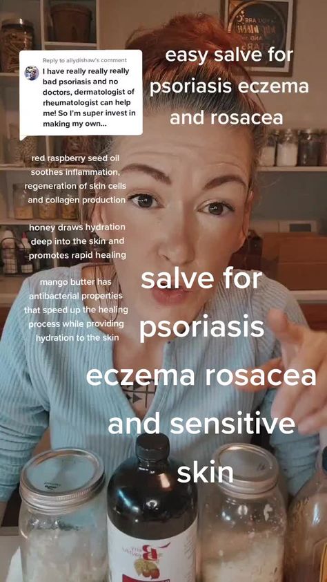 Triple Brigid Apothecary on TikTok Raspberry Seed Oil, Red Raspberry, Mango Butter, Healing Process, Skin Cells, Apothecary, Seed Oil, Sensitive Skin, Healing