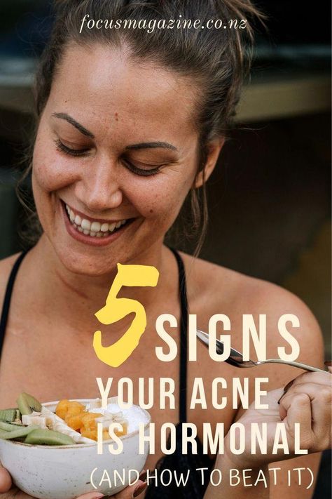 Hormonal Acne Skincare Routine, Hormonal Acne Skincare, Skincare Routine Acne, Cheek Acne, Hormonal Acne Diet, Acne Diet, Forehead Acne, Pimples Under The Skin, Bad Acne