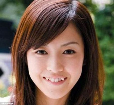 A young woman who has undergone a cosmetic procedure to get crooked, fang-like teeth after the look became popular in Japan Teeth Fangs Natural, Beauty Myth, Canine Tooth, Crooked Teeth, Japanese Cosmetics, Straight Teeth, Teeth Straightening, Perfect Teeth, Teeth Braces