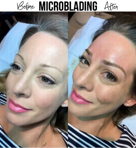 Microbladed eyebrows- this post answers all your questions including: what is it, does it look real, does it hurt, how long does it last, what does it cost?? Tatooed Eye Brows, Eyebrow Examples, Nanobrows Before And After, Mircoblading Eyebrows, Eyebrows Tattoo, Eyebrow Before And After, Eyebrows Goals, Micro Blading, Eyebrow Microblading