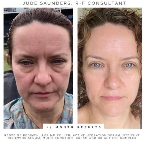 Step-by-step Multi-Med Therapy Rodan + Fields gives your skin the right dose of ingredients in the right order for the best results. Jude uses our Redefine Regimen + Redefine AMP MD System and she glowing🤩 You deserve the perk of products that work! This month only, enroll in our Preferred Customer Perks program for FREE. See graphic for the great benefits of PC Perks. Rodan Fields Skin Care, Redefine Regimen, Cream For Dark Circles, Under Eye Cream, Anti Aging Regimen, Green Skincare, Dark Eye Circles, Eye Cream For Dark Circles, Under Eye Puffiness