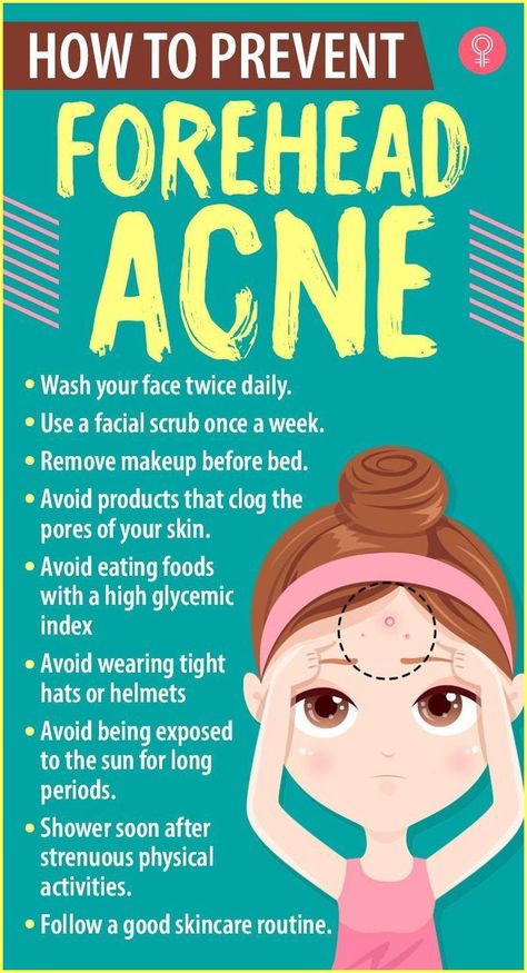 Pimples On Forehead, Forehead Acne, Pimples Under The Skin, Bad Acne, Acne Overnight, Sunday Routine, Prevent Pimples, Acne Face Wash, Natural Acne Remedies