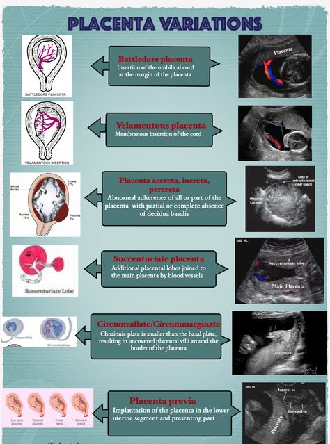 placenta  ultrasound Sonography Notes Ultrasound, Ultrasound Notes Study, Ultrasound Technician Notes, Ultrasound Technician Aesthetic Notes, Diagnostic Medical Sonography Student Notes, Sonography Student Notes, Ultrasound Tech Study Notes, Black Ultrasound Technician, Ultrasound Technician Student Notes