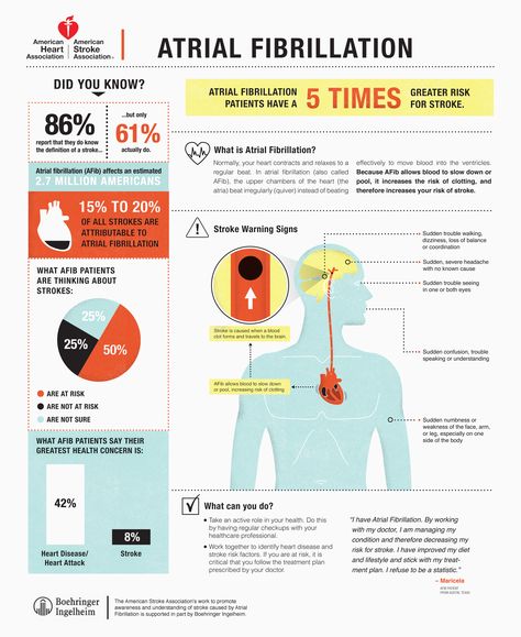 Learn more about atrial fibrillation, how it affects your how and increases your risk of stroke. Doctors And Patients, Nursing Board, Nursing Mnemonics, Cardiac Nursing, Nurse Rock, Atrial Fibrillation, Nursing Tips, Future Nurse, Emergency Medicine