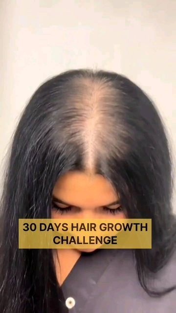 hair growth tips haircare haircare tips aesthetic hair hair tips hair growth oil grow hair faster      
hair growth tips how to grow your hair faster haircare hair growth hair tips hair mask hair care Homemade Hair Growth Serum, Hair Fall Remedies, Hair Fall Remedy Home, Tips For Long Hair, Homemade Hair Growth, Hair Thickening Remedies, Removing Hyperpigmentation, Ways To Grow Hair, Dry Hair Mask