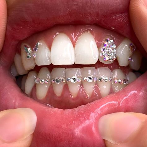 Teeth Bling, Tooth Jewellery, Teeth Diamond, Shiny Teeth, Teeth Gems, Pretty Teeth, Dental Jewelry, Tooth Jewelry, Grillz Teeth