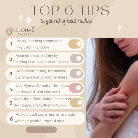 "🌿 Beat the heat with Ayurvedic wisdom! Say goodbye to pesky heat rashes with these natural remedies. Stay cool, comfortable, and confident all summer long. Click here for more: https://shorturl.at/uBCHI ☀️ #Ayurveda #NaturalRemedies #CoolingTips" Brahmi Benefits Ayurveda, Tri Doshic Ayurveda, Ayurveda What Is, Tridoshic Ayurveda, Calamine Lotion, Heat Rash, Ayurvedic Remedies, Ayurvedic Herbs, Beat The Heat