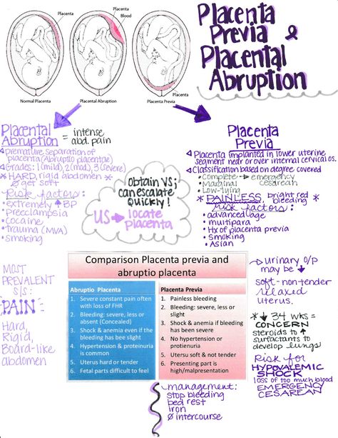 Nursing Maternity Cheat Sheet, Placental Abruption Nursing, Maternal Nursing Notes, Obstetrics And Gynecology Notes, Labor And Delivery Nurse Cheat Sheet, Ob Nursing Notes, Gynaecology Notes, Midwifery Student Notes, Ob Nursing Student Cheat Sheets