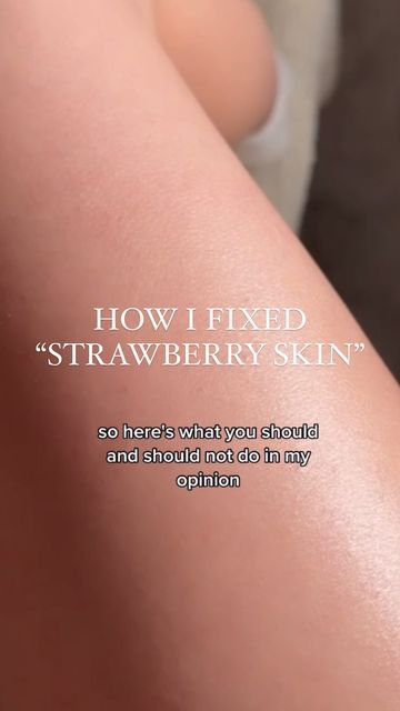 How To Deal With Strawberry Skin, Smooth Arms Skin, Diy How To Get Rid Of Strawberry Legs Fast, Legs Care Routine, How To Prevent Strawberry Skin, Strawberry Arms Remedy, Kerotisis Pilaris, Kp Skin Remedies, How To Fix Strawberry Skin