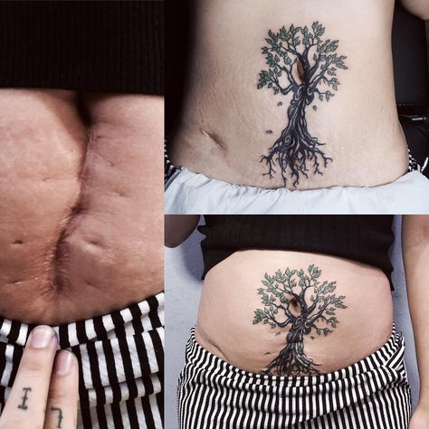 Tatuajes sobre la cicatriz de la cesárea: 17 ideas por si lo estás considerando Vertical Stomach Tattoos, Spice Closet, Scar Repair, Tattoo Scar, Scar Cover Up, Coverup Tattoo, Tattoos To Cover Scars, Scar Tattoo, Ink Well