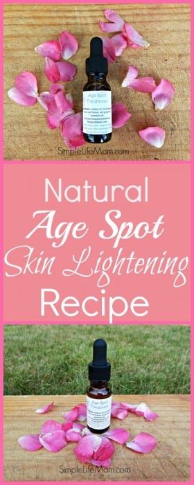 Natural Age Spot Skin Lightening Recipe Serum Recipe, Acne Prone Skin Care, Lotion For Oily Skin, Age Spot, Cream For Oily Skin, Anti Wrinkle Skin Care, Frankincense Myrrh, Using Essential Oils, Skin Care Wrinkles