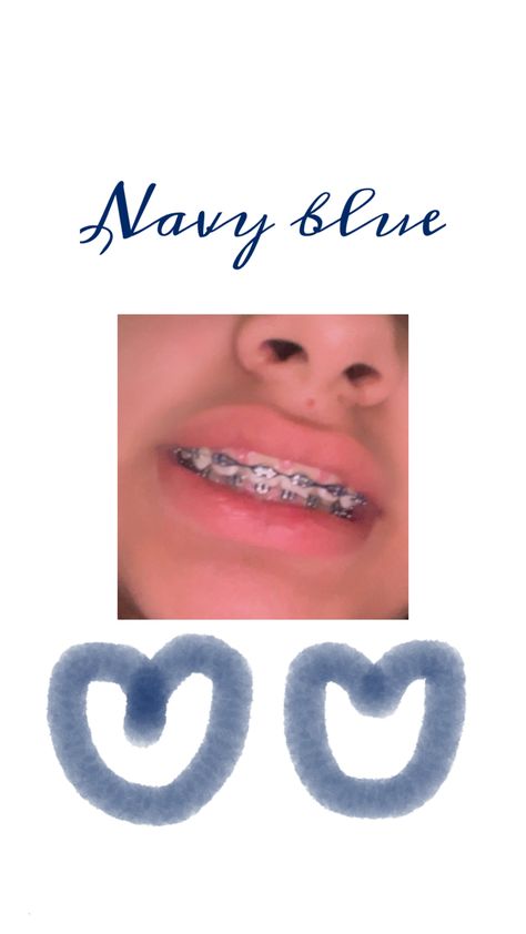 Navy Blue Braces, Blue Braces, Braces Colors, Braces, Navy Blue, Navy, Blue, Color