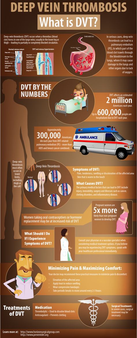 Deep Vein Thrombosis - What is it? Dvt Awareness, Vein Thrombosis, Dancer Workout, Nursing Tips, Nursing Study, E Mc2, Nursing Education, Nursing Notes, Medical Knowledge