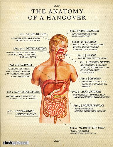 Anatomy of a Hangover | posted by columnfive on flickr / Sloshspot article dated13Mar2009 #Infographic Bad Morning, The Hangover, Quit Drinking, Anatomy And Physiology, Blood Vessels, Things To Know, Headache, Healthy Habits, Home Remedies