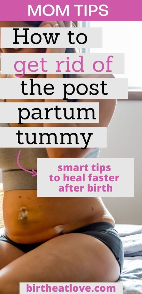 Post Partum Recovery Stretches, 6 Months Post Partum Belly, Postpartum Body Care, Postpardom Recovery, Post Partum Supplements, Post Partum Body Pictures, Postpartum Glow Up, Postpartum Makeover, Post Partum Belly