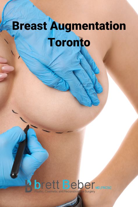 breast augmentation Toronto by Dr Brett Beber Augmentation Before And After, Saline Implants, Silicone Implants, Breast Surgery, Do's And Don'ts, Breast Augmentation, Plastic Surgeon, Cosmetic Surgery, Healing Process