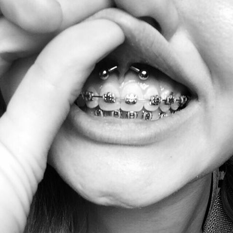 Smiley Piercing, braces, no pain, piercings, goal, got it done yesterday, chech A Smiley Piercing, Orthodontic Appliances, Smiley Piercing, Cute Piercings, Makeup Clothes, Lip Piercing, Ear Cuffs, Braces, Got It