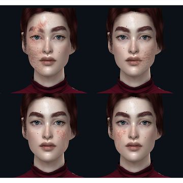 Sims 4 Face Scars Cc, Sims 4 Burn Scars Cc, Sims 4 Cc Face Scars, Sims 4 Scars Cc, Lightning Scar, Harry Potter Face, Facial Scars, Sims 4 Children, Skin Details