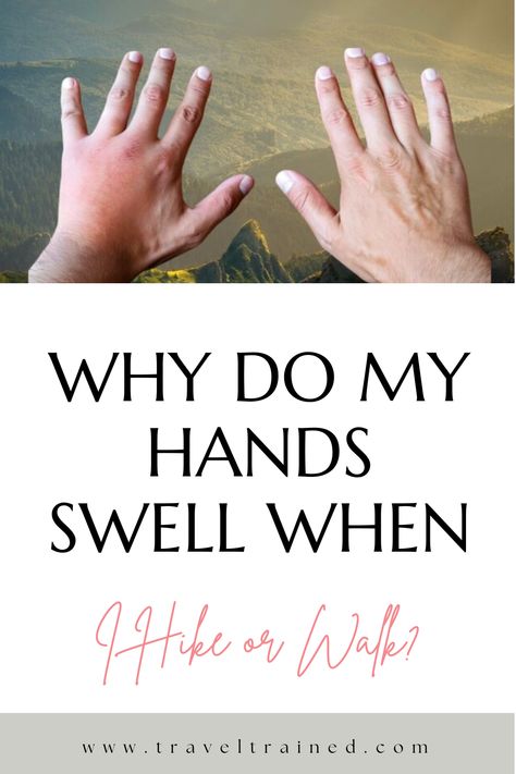 Reduce Swelling In Hands, Swollen Hands Remedy, Essential Oil For Swelling, Swelling Remedies, Tingling Hands, Swollen Hands, Running Warm Up, Hand Soak, Sweaty Hands