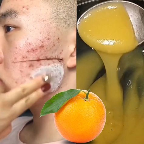 Orange Face Mask, Homemade Skincare, Orange Peels, Orange Skin, Beauty Diy, Anti Wrinkle Cream, Orange Cream, Diy Homemade, Orange Peel