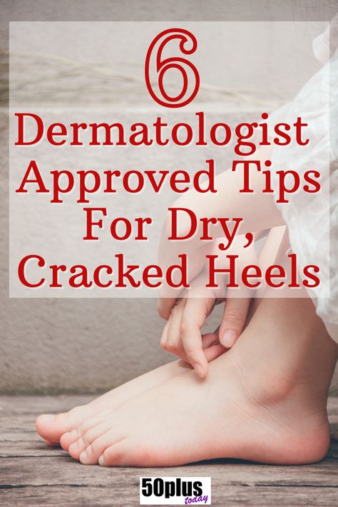 6 DERMATOLOGIST APPROVED TIPS FOR DRY CRACKED HEALS Dry Cracked Feet Home Remedy, How To Get Smooth Heels, Soft Heels Remedies, How To Remove Dry Skin From Heels, Cracked Feet Remedies Heels, Heel Softener Remedies, How To Soften Heels, How To Get Rid Of Rough Heels, How To Heal Cracked Feet Fast